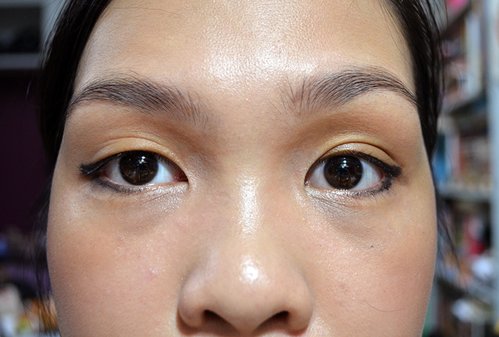 Winging it Out for Weird Eye Folds