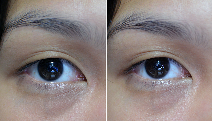 BRTC Bright Eye Vitalizer Cream - Before and After