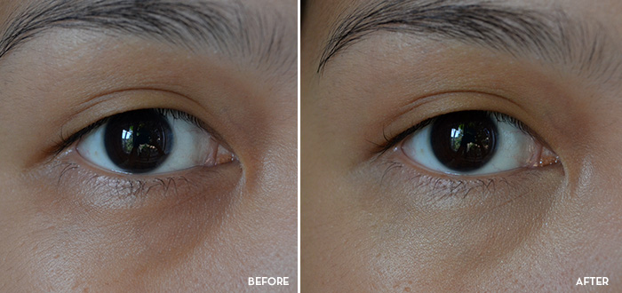 Happy Skin - Eye Need a Miracle - Before and After