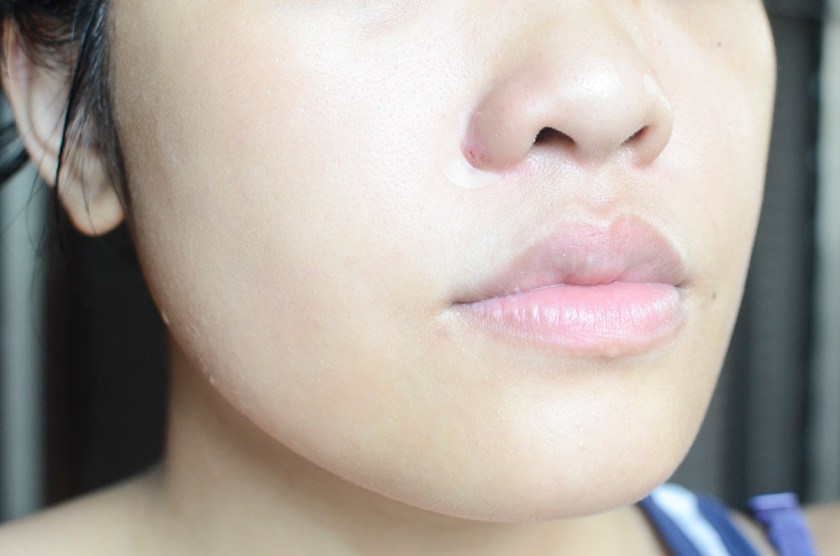 Leaders AC-Free Spot Patch - Face