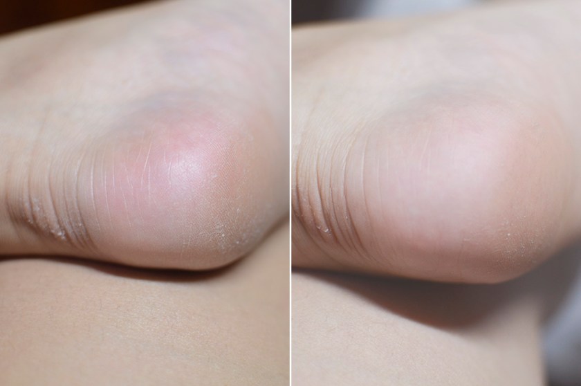 Leaders Moisture Therapy Body Oil Cream - 1 Application